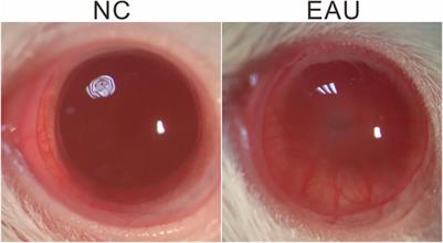 Integrated Transcriptome Analysis of Iris Tissues in Experimental Autoimmune Uveitis